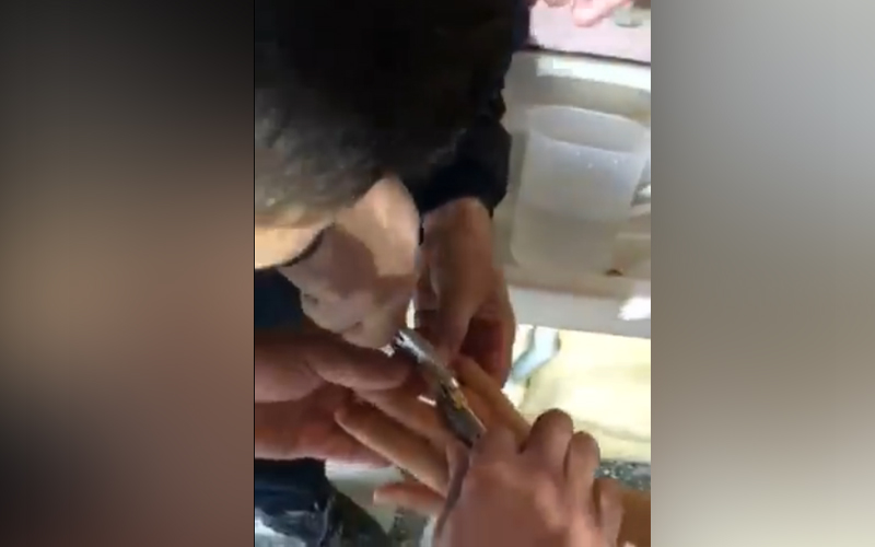Cerrah değil itfaiyeci müdahalesi