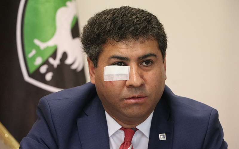 Atilla: Ankaragücü Başkanı bana yumruk attı