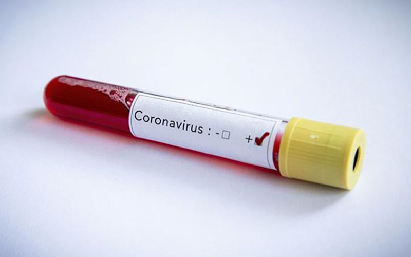 Coronavirüsün yayılmasına yol açan en önemli 3 neden belirlendi