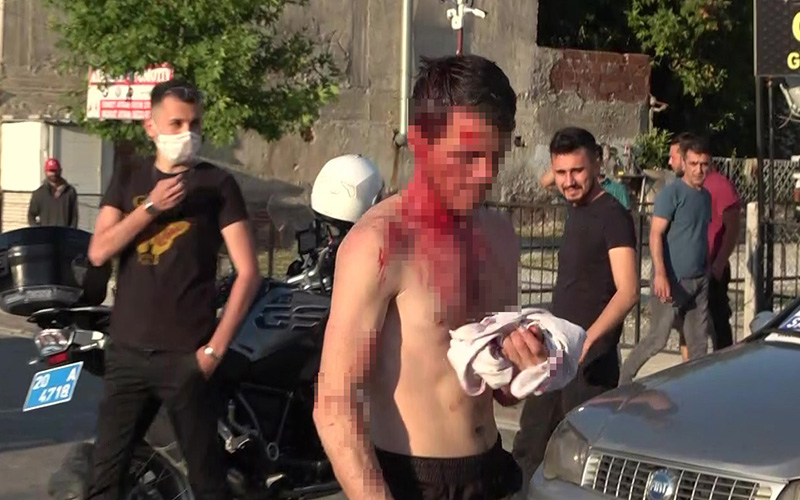 Husumetli iki aile arasında kavga çıktı: 2 yaralı, 3 gözaltı