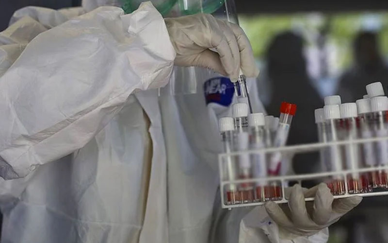 BBC Türkçe’den Denizli’nin de yer aldığı 11 ilde coronavirüs ve ek ölümler araştırması