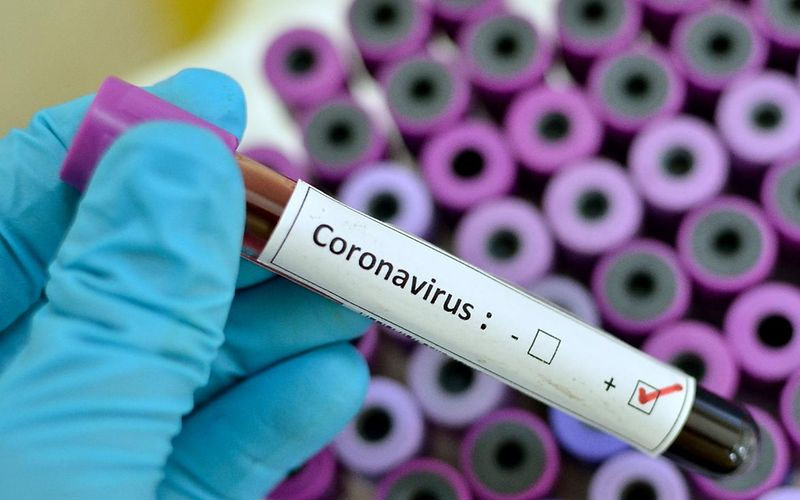 Tedavisi evinde yapılan coronavirüs hastası öldü
