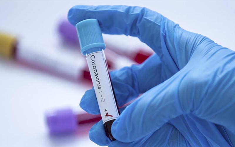 Omicron varyantı Türkiye’de, görülen iller açıklandı