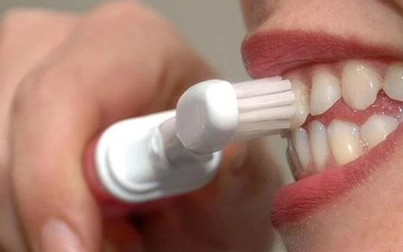 İnternetten alınan diş beyazlatma kitleri için zarar verebilir uyarısı