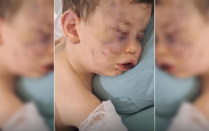 Bebeğe vahşeti yaşattılar, hastaneye yara bere içinde getirildi