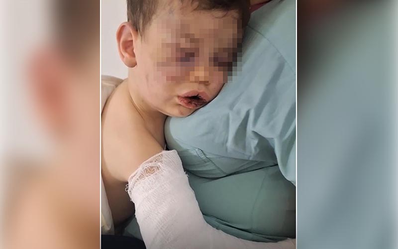 Bebeği bu hale getiren zanlı gözaltına alındı