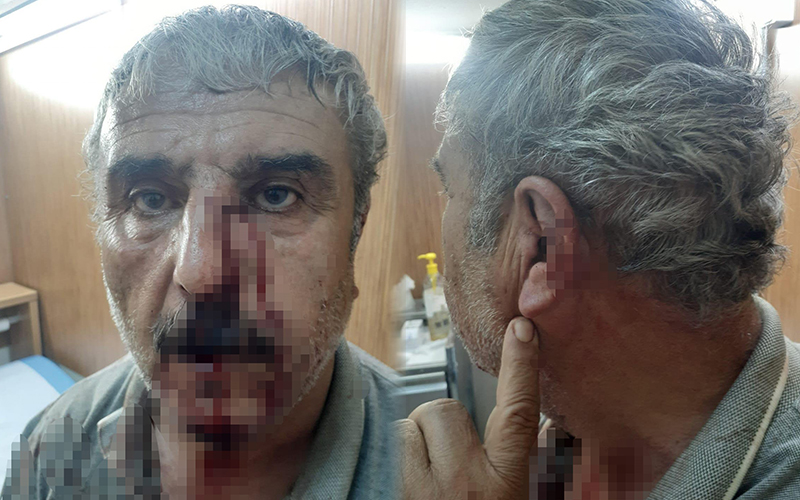 Doktor ile emekli öğretmenin kavgası karakolda bitti